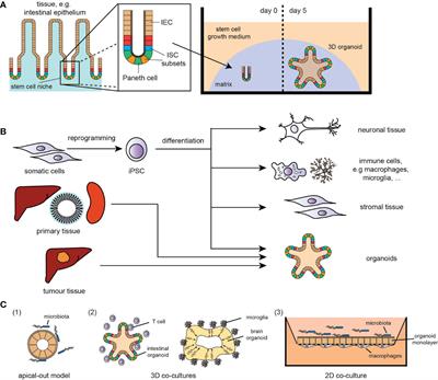 Stem Cells and Organoid Technology in Precision Medicine in Inflammation: Are We There Yet?